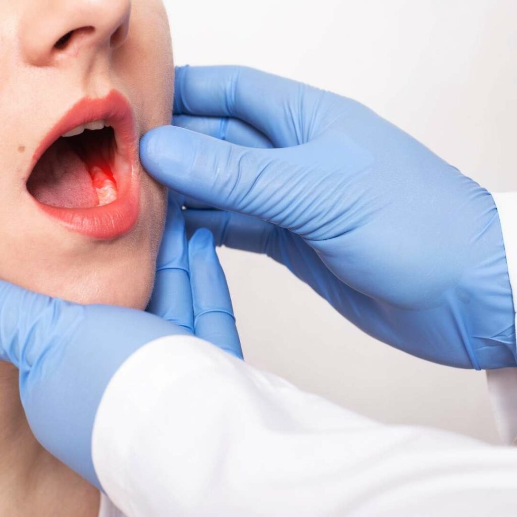 Gum diseases treatment in Saint John