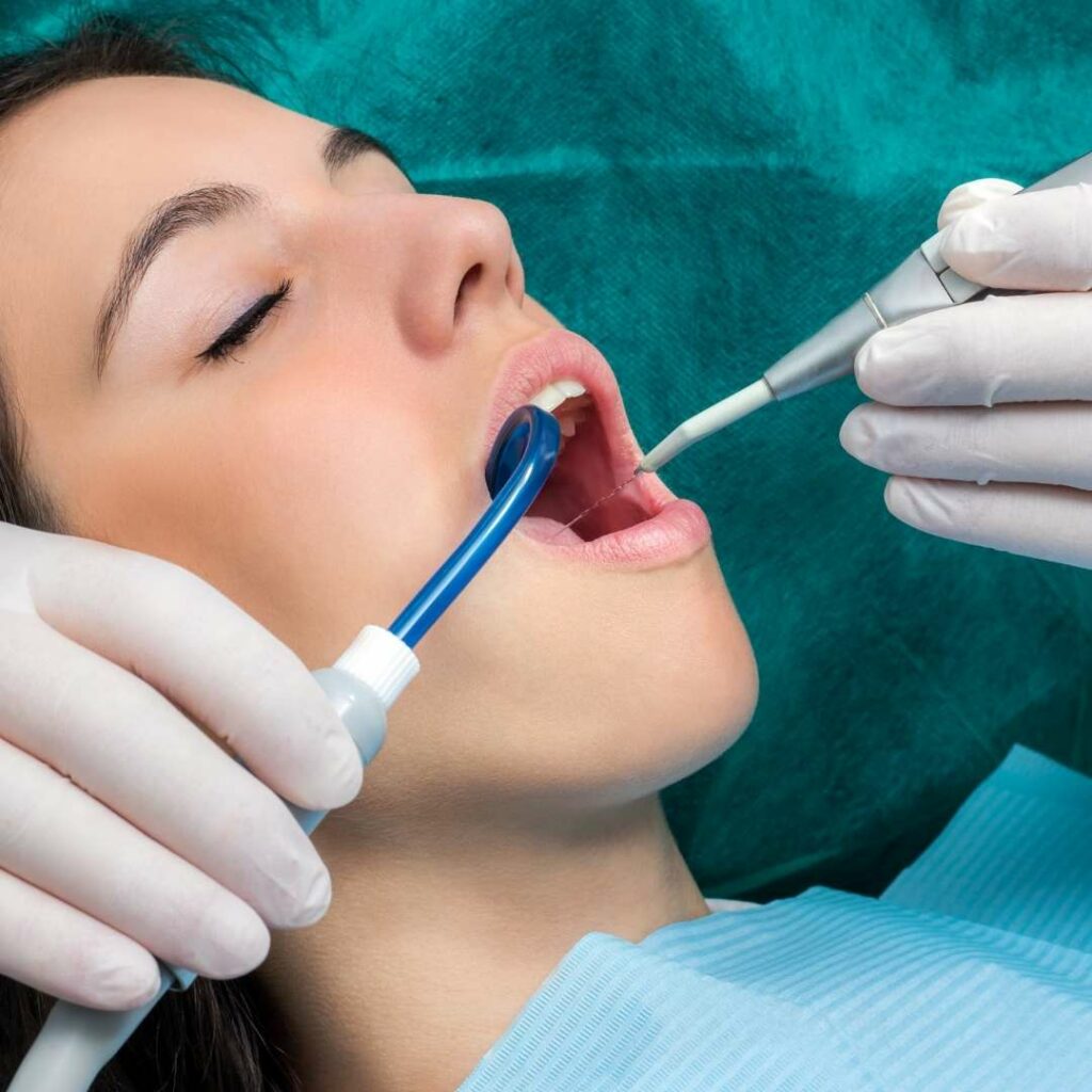 Teeth Cleaning in Saint John