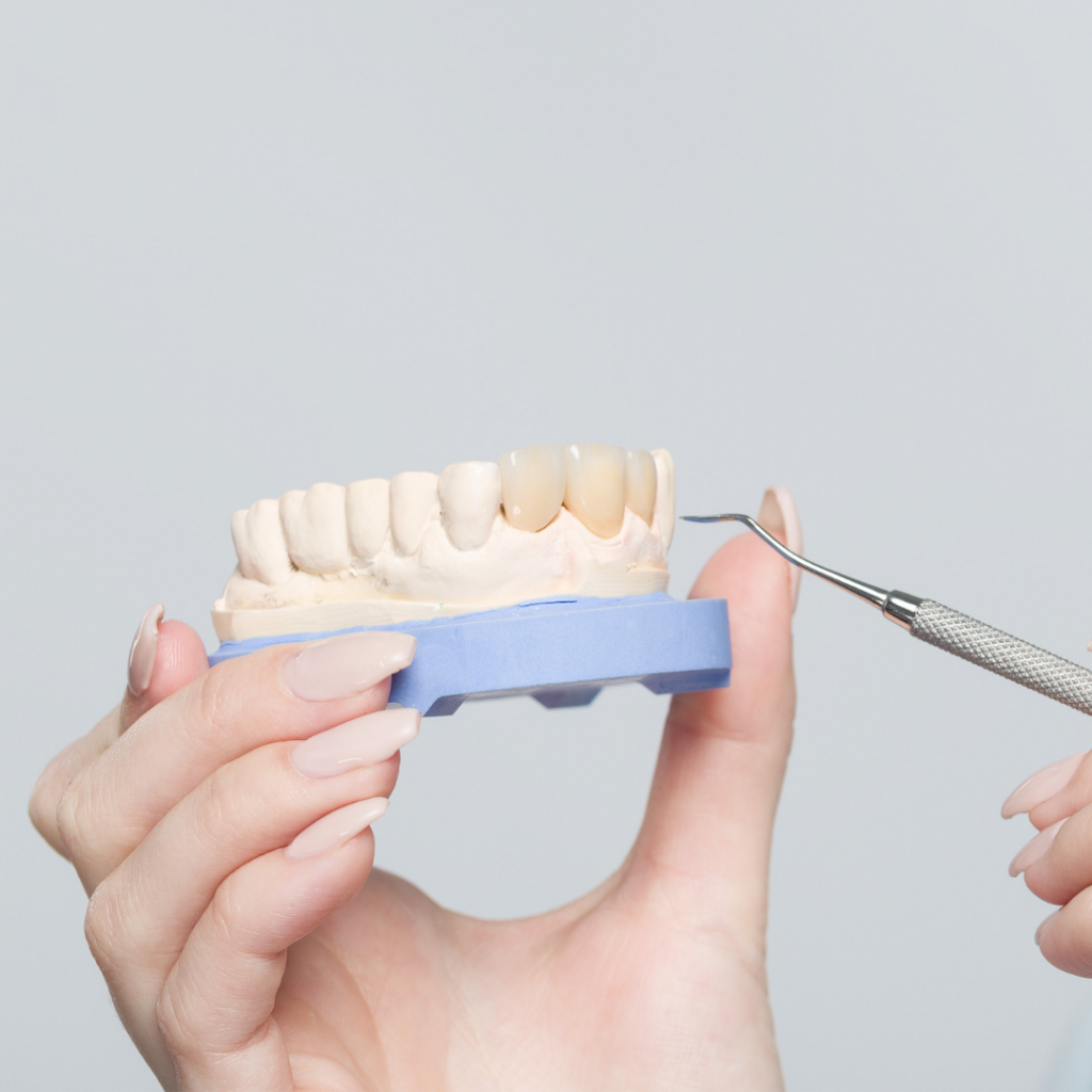 Dental Bridges in Saint John