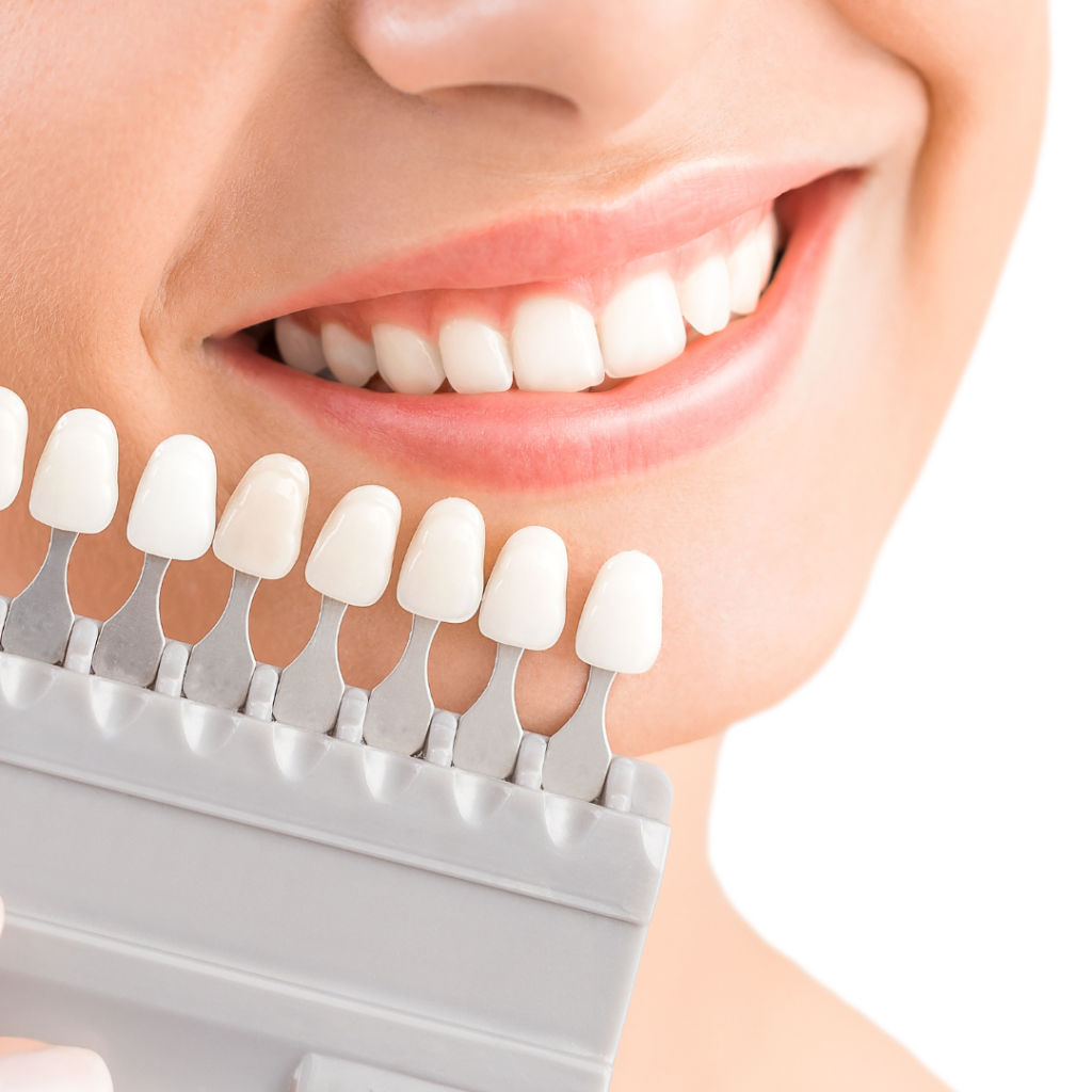 Dental Crowns in Saint John